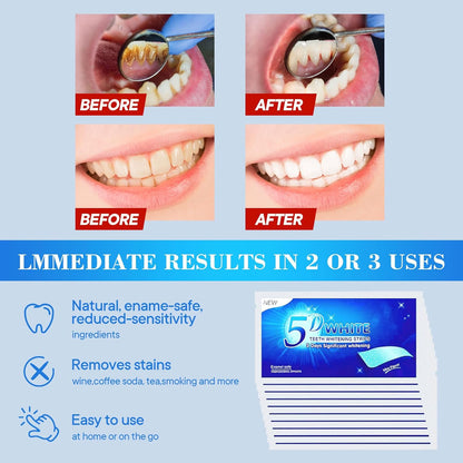 Whitening Strips,28 Strips Zahnaufhellung Peroxid Frei Teeth Whitening Strips Zähne Aufhellen Non-Sensitive Formel Bleaching Stripes White Stripes Zähne Sicher Für Zahnschmelz Mit Minzgeschmack