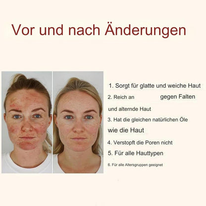 100G Beef Tallow Skincare, Rindertalg Hautpflegecreme, Rindertalg Balm, Beef Tallow Rindertalg Creme Talg Creme Gesicht Nährend Feuchtigkeitsspendend Feuchtigkeitscreme Für Die Körperhaut